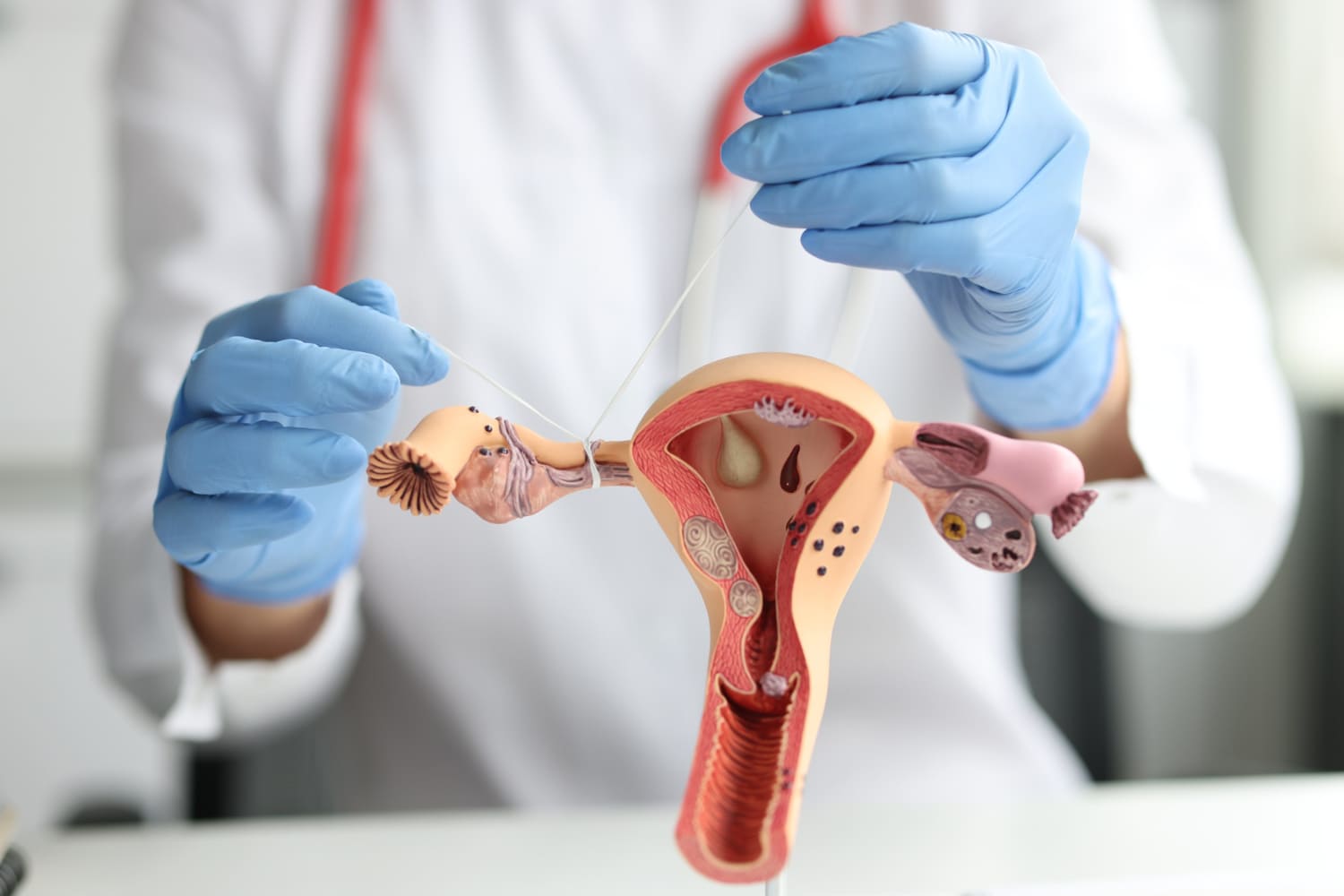 Esterilización quirúrgica